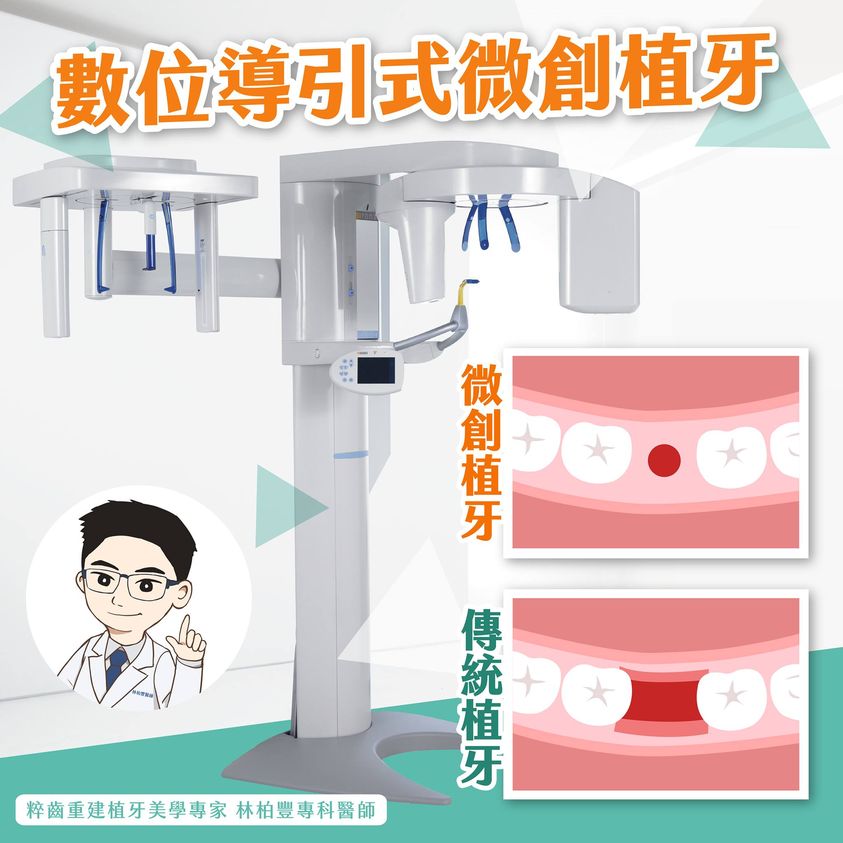 數位導引式微創植牙